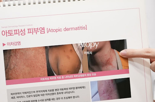 생기한의원으로 보는 소아 아토피 피부 변화 확인 방법